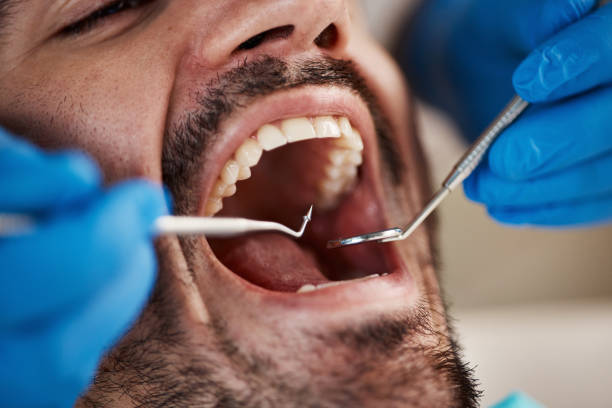 Best Emergency Dental Care for Sports Injuries in Estill Springs, TN
